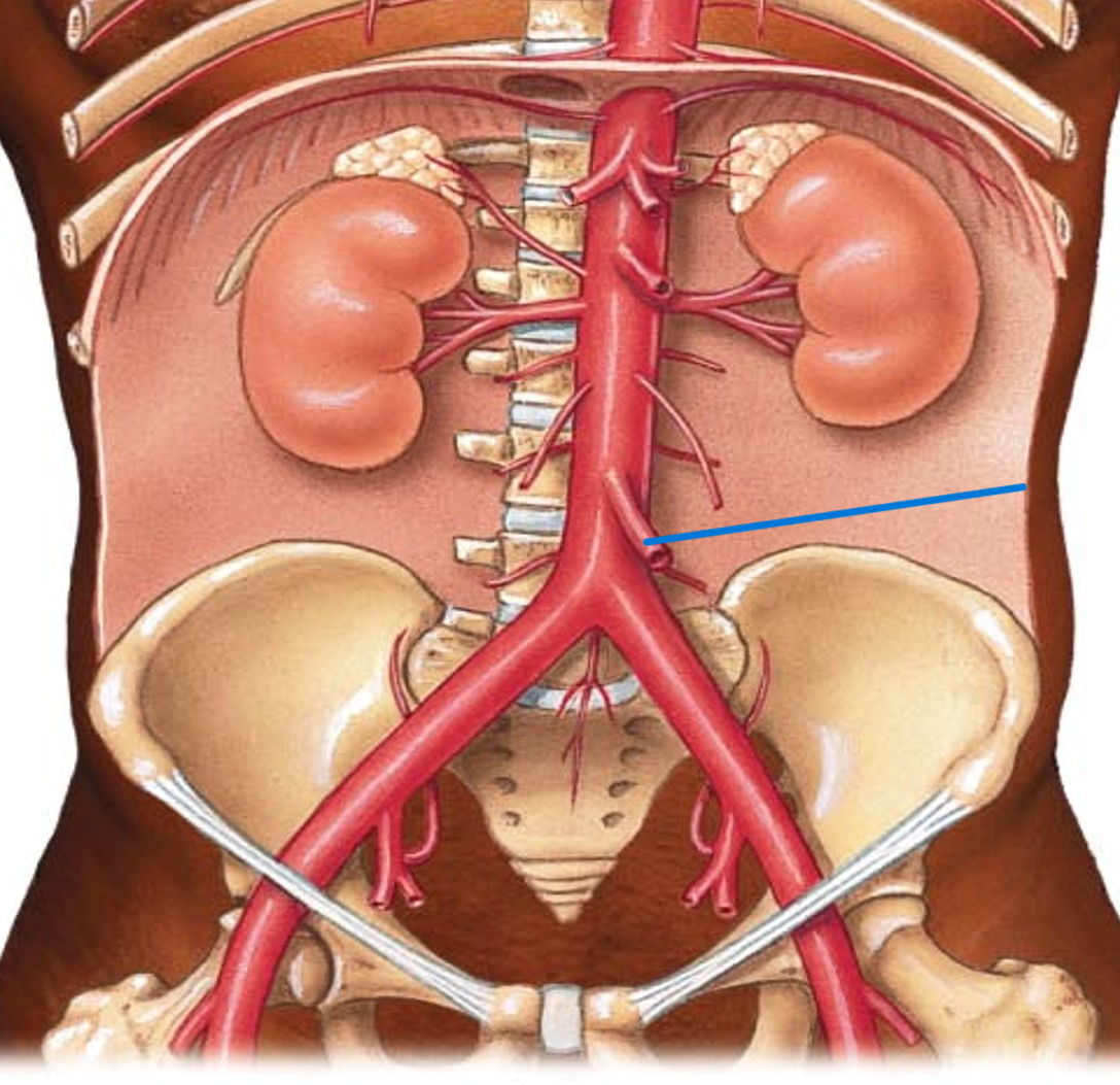 <p>Name the artery</p>