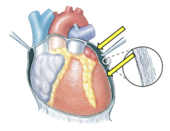 <p>structure including both layers</p>