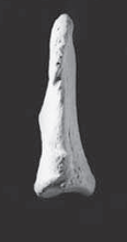 <p>distal hand phalanges (lateral)</p>