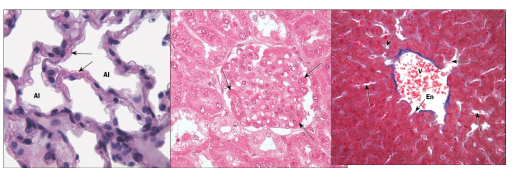 <p>Three types recognized</p><ul><li><p>Continuous: complete endothelial lining, most common</p></li><li><p>Fenestrated: 60–80 nm diameter membrane-covered pores present</p></li><li><p>Sinusoidal: larger, discontinuous endothelium promoting exchange</p></li></ul><p></p>