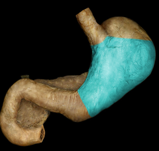 <p>the main, central portion of the stomach</p>