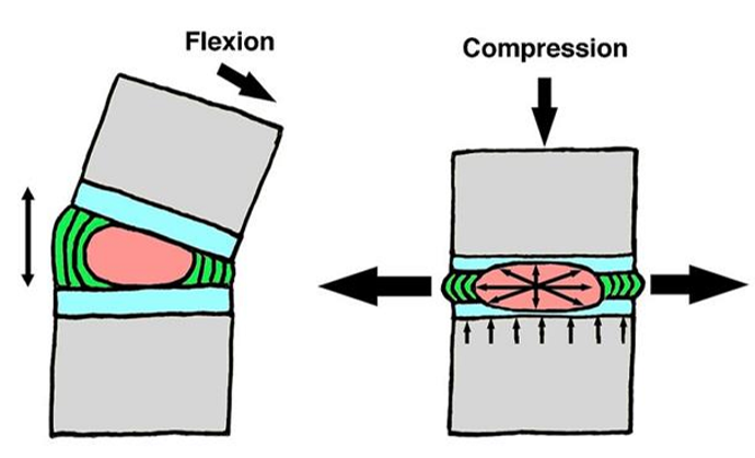 <ul><li><p>Gelatinous consistency</p></li><li><p>Shock absorber → disperses compressive forces</p></li><li><p>Deforms but is not compressible</p></li><li><p>Ability to hold water (why we are 1-2 cm taller in the morning - water retained in the nucleus pulposus when we sleep)</p></li></ul><p></p>