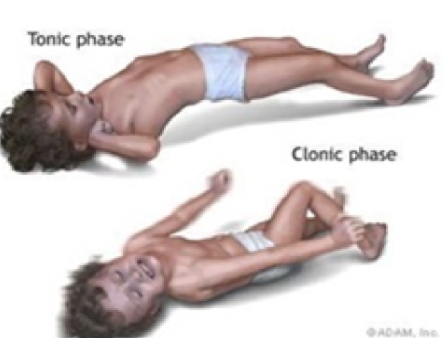 <ol><li><p>last 2-5 minutes</p></li><li><p>tonic phase: stiffening, rigidity, LOC</p></li><li><p>clonic phase: rhythmic jerking of extremities</p></li><li><p>post-ictal: fatigue, confusion, lethargy (up to 1 houe)</p></li></ol><p></p>