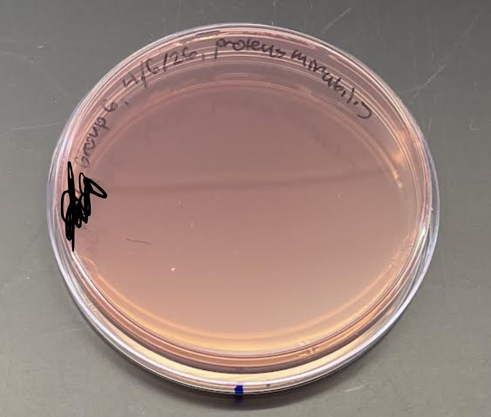 <p>What is the plate’s name, selective agents, select for, differential agents, differentiates between, and everything about it?</p>