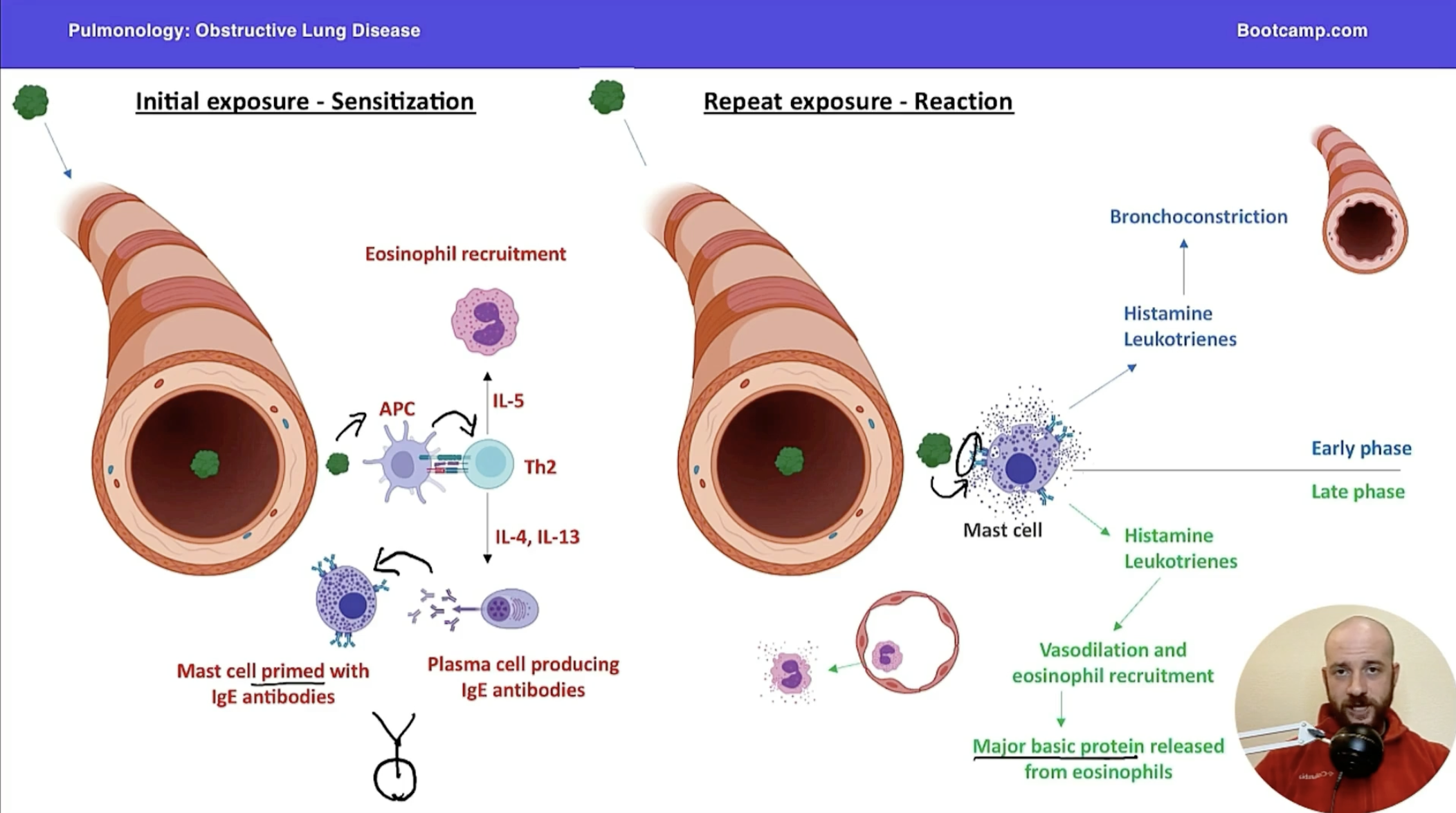 <p><strong><u>Phase 1: Sensitization</u></strong><br>(1) Initial exposure to allergen --> Th2 cells presented with antigen by antigen present cell (APC) <br>(2) Th2 --> does 2 things<br>First, IL-5 for eosinophil recruitment<br>Second, IL-4 and IL-13 which leads to plasma cell producing IgE antibodies against allergen<br>(3) End result: Mast cell primed with IgE antibodies <br><br><strong><u>Phase 2: Reaction (repeat exposure)</u></strong><br>(1) Antigen binds to IgE on mast cell and mast cell degranulates releasing histamine & leukotrienes <br>(2) Early phase: Histamine & leukotriene cause bronchoconstriction <br>(3) Late phase: Histamine & leukotriene lead to vasodilation and eosinophil recruitment <br>Eosinophil releases major basic protein --> inflammation and mucus production </p><p></p>