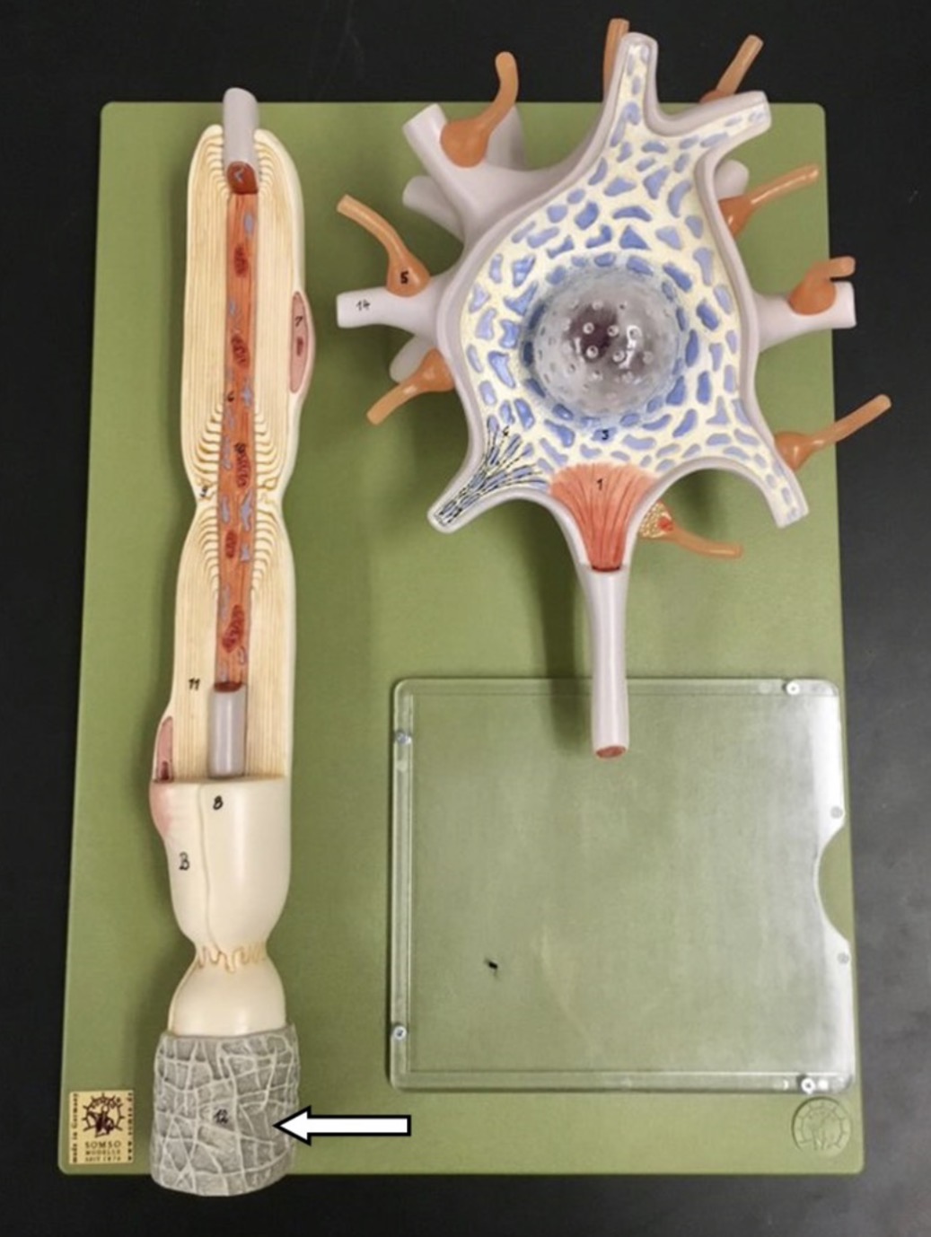 <p>What is the arrow pointing to?</p>