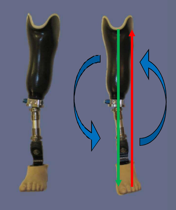 <p>lateral proximal, medial distal </p>