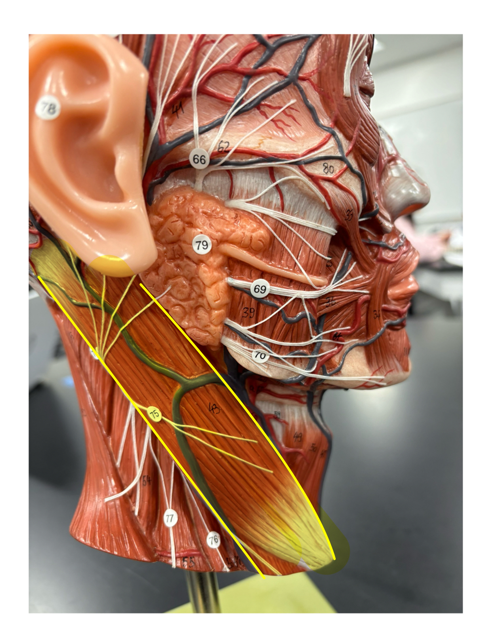 <p>name the muscle and its action</p>