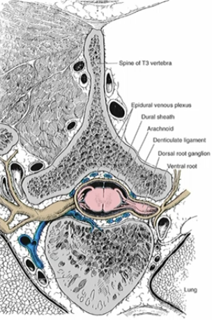 <p><strong>vertebral body</strong> and a posterior <strong>vertebral arch </strong>(lamine and spinous process)</p>