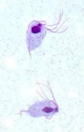 <ul><li><p>found in crop washings of pigeons, doves, and poultry </p></li><li><p>transmitted through drinking water </p></li><li><p>looks like subnautica bladder worm with a little tail and many antennae  </p></li></ul><p></p>