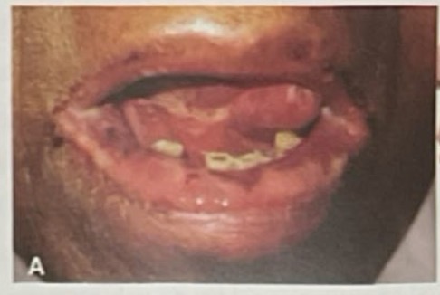 <p>CHẨN ĐOÁN?</p>