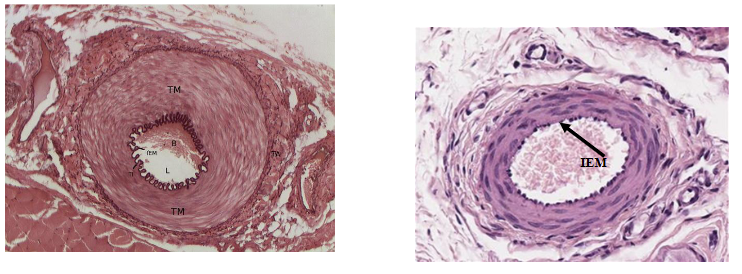 <p>medium and small arteries (distributing arteries) can regulate blood flow to various regions of the body</p><p>*IEM = internal elastic membrane</p>