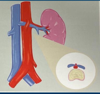 <p>which syndrome is this?</p>