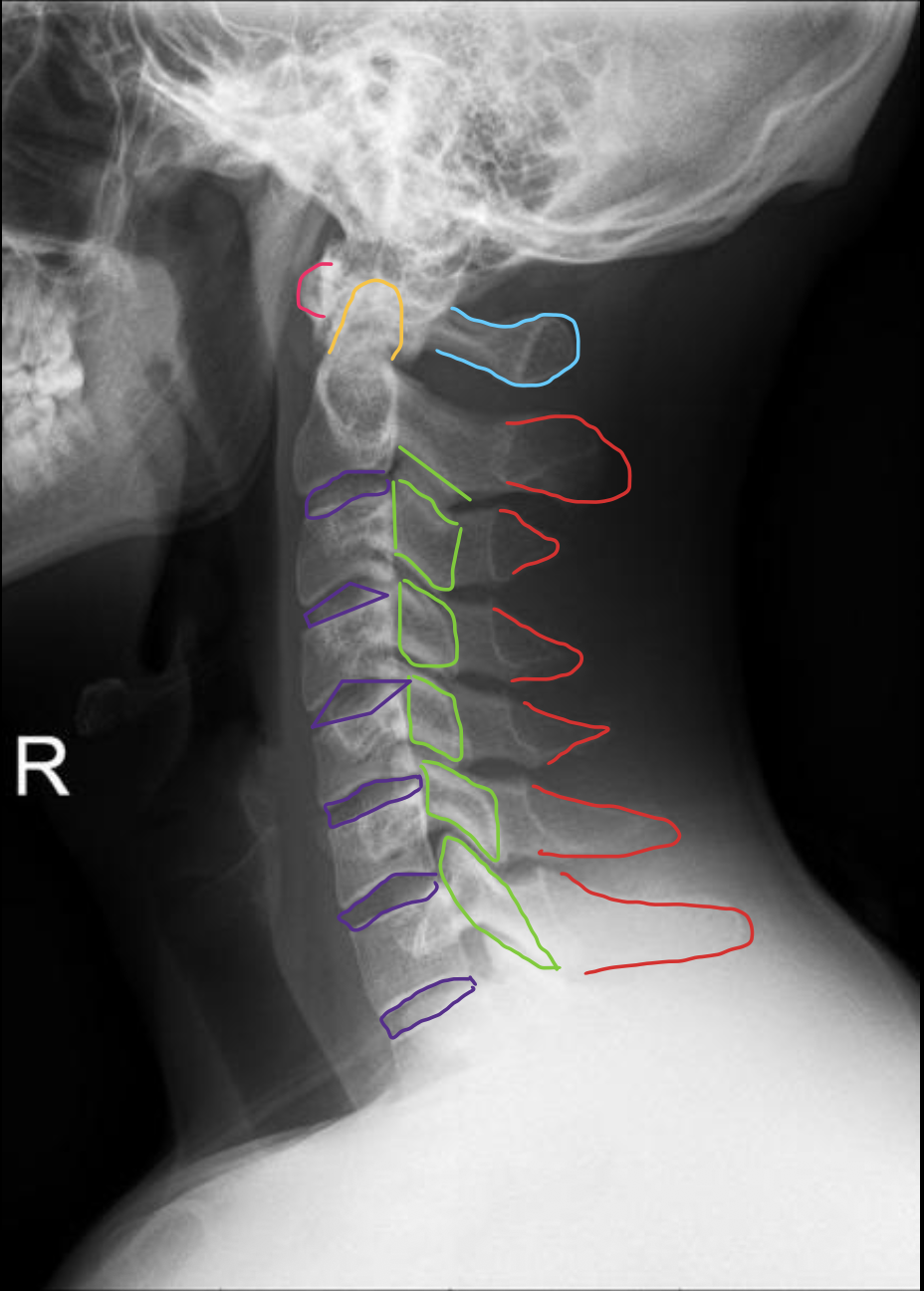 <p><span>寰椎后弓及后结节</span></p>