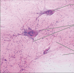 <p>name the tissue: neurons are branching cells; processes may be long, extending from the cell body</p>