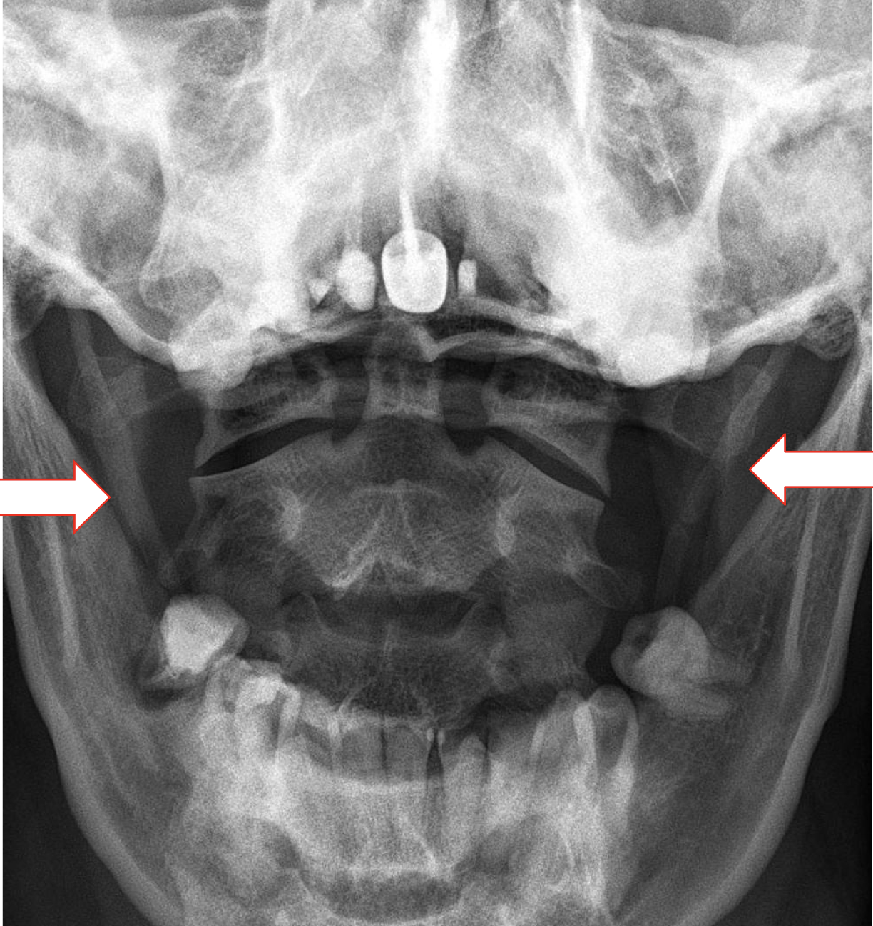 <p>What are the arrows pointing to on this image</p>