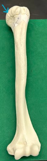 <p>ID humerus region </p>