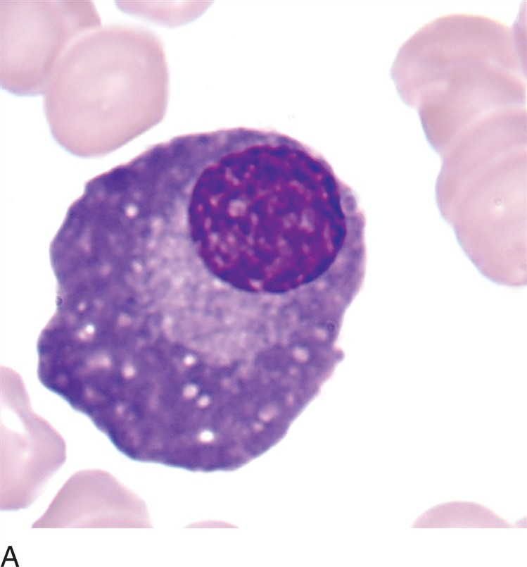 <p>what is a plasma cell?</p>