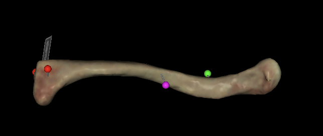 <p>what’s the <mark data-color="#f7adad" style="background-color: rgb(247, 173, 173); color: inherit;">red</mark> tag of the left clavicle?</p>