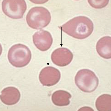 <p>name the type of RBC</p>