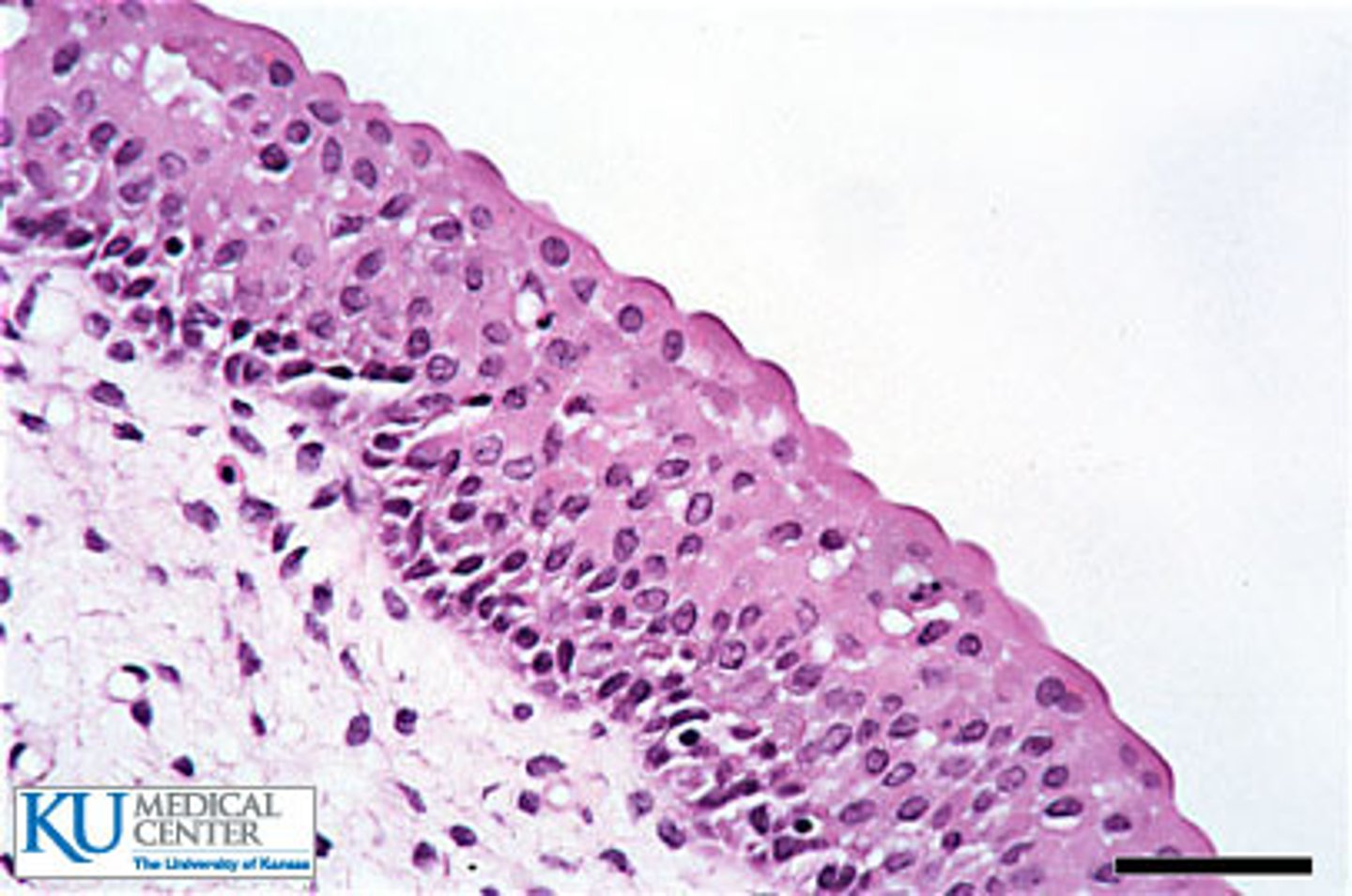 <p>Transitional Epithelium</p>