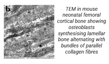 <p>Uses electrons to visualise ultrastructural details within cells at high resolution, allowing for detailed imaging of cell organelles and membranes, the primary electron beam is transmitted through a thin sample, and then detected on the other side. The electrons are interacting (being absorbed and emitted) with structures inside the sample and are therefore able to produce a higher resolution image than through the collection of scattered secondary electrons. It can only produce 2D images of a small area</p>