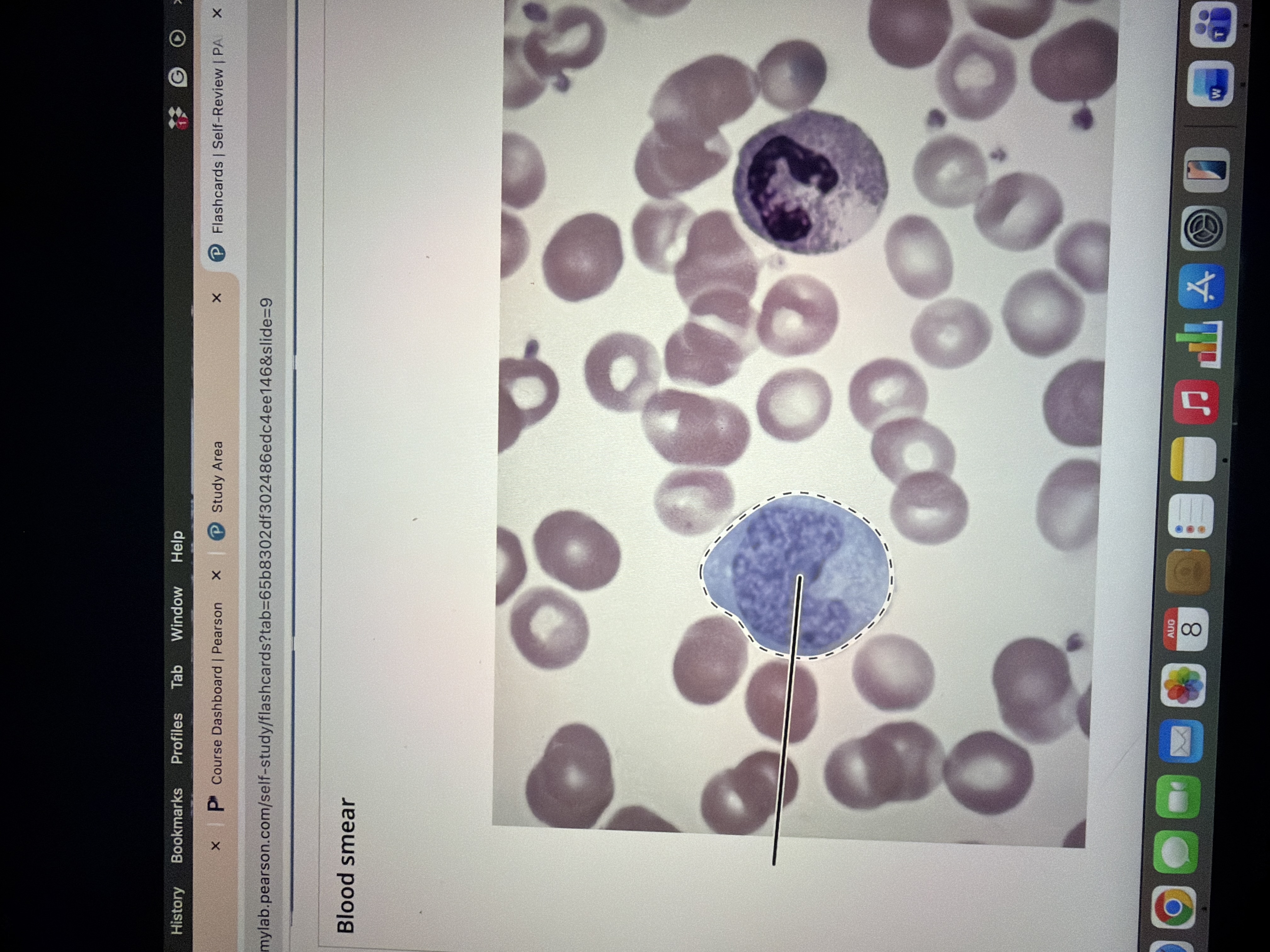 <p>Blood smear </p>