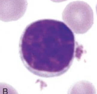 <p><span>Which type of white blood cell is shown in this picture? What are the characteristics of this type of white blood cell?</span></p>