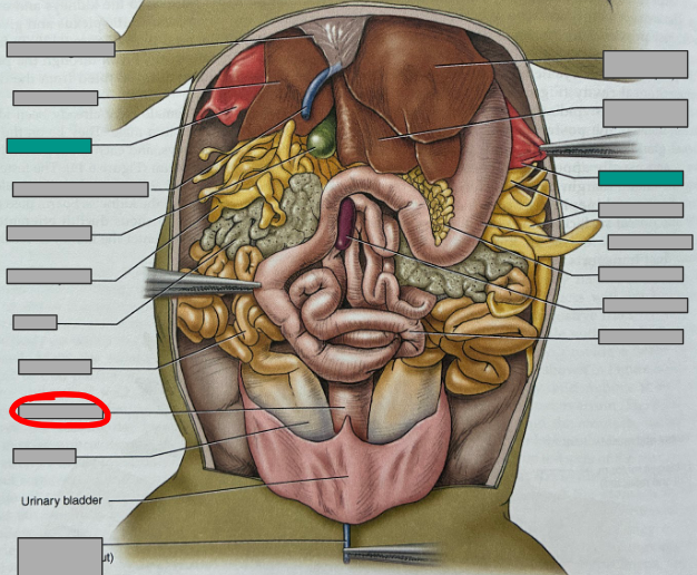 <p>What part of the organism is this?</p>