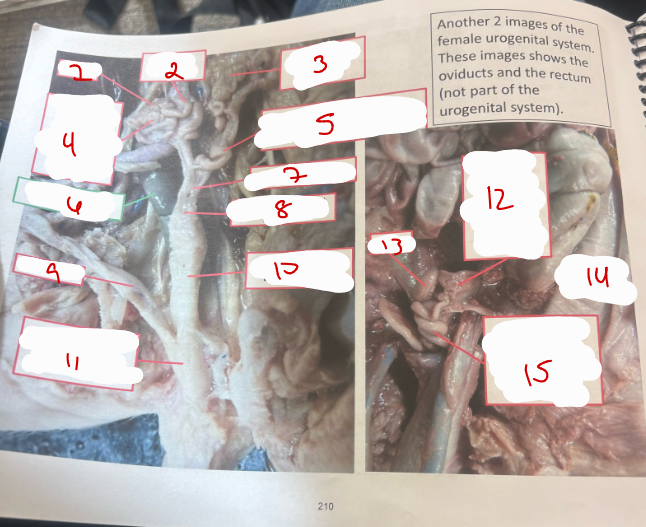 <p>Female Urogenital System 2</p>