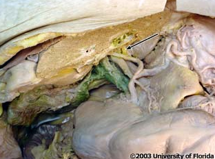 <p>what artery is being indicated to in the image?</p>
