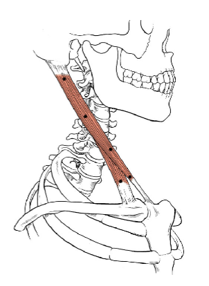 <p>What muscle is this?</p>