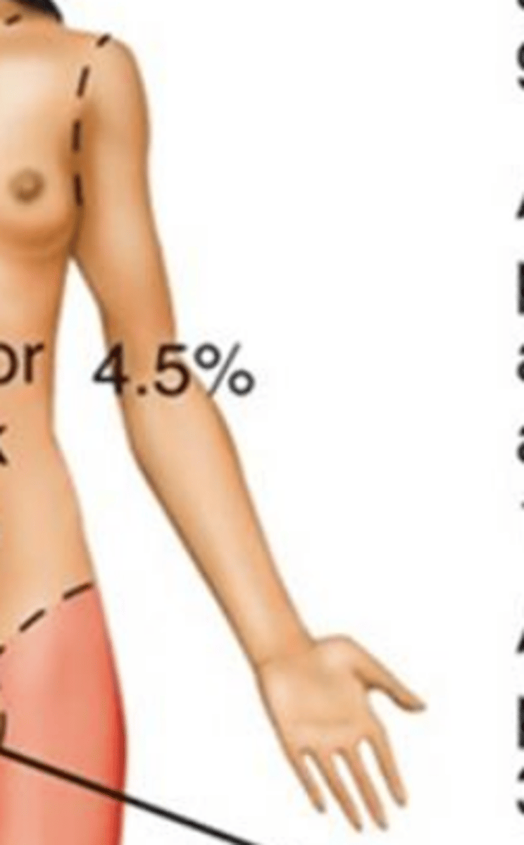 <p>18%</p>