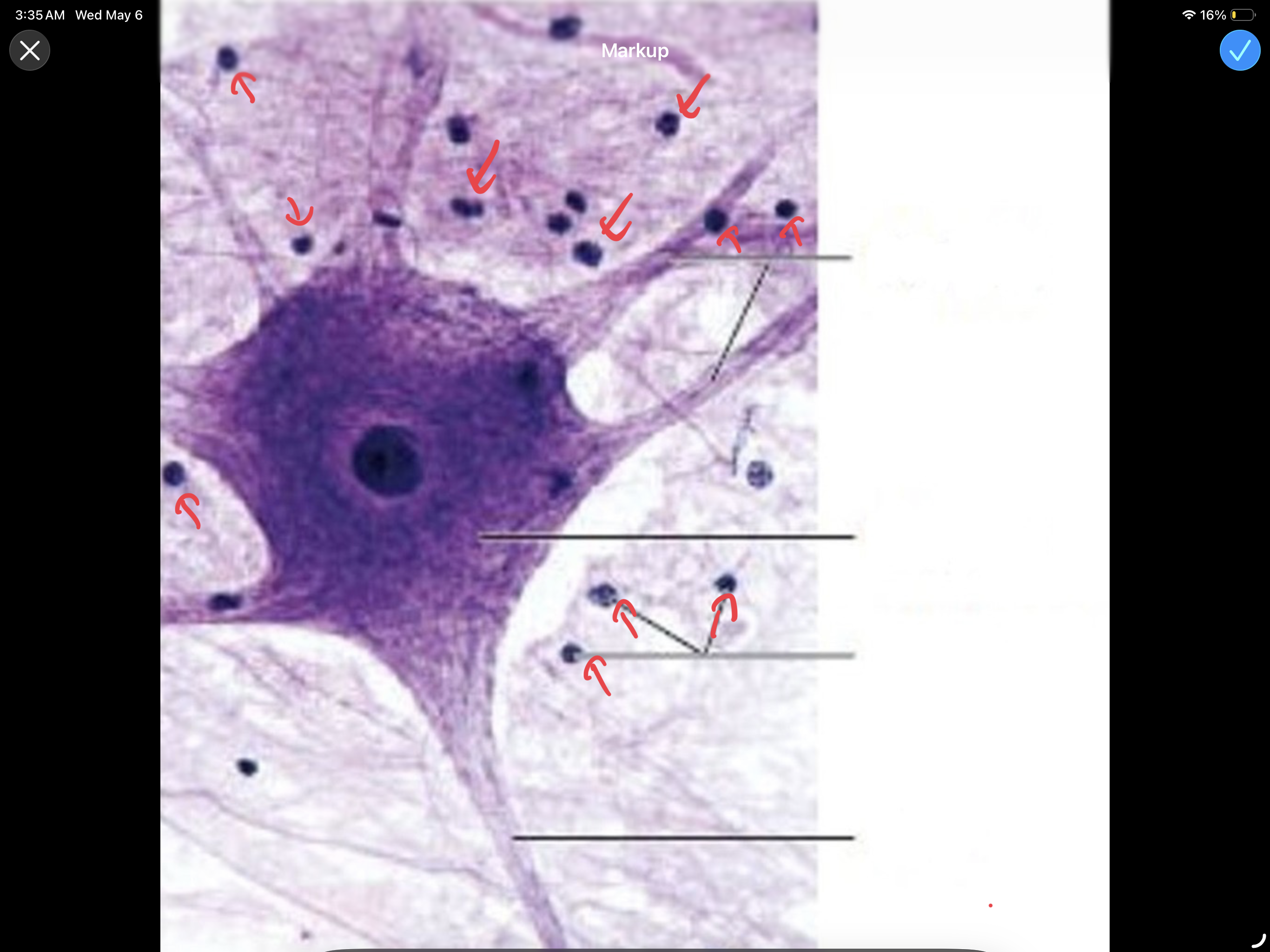 <p>Nuclei of Glial Cells; small cells that support the neuron.</p>