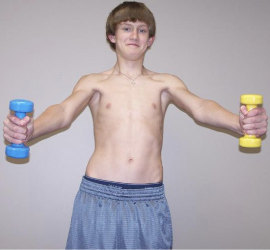 <p>Shoulder abduction in the scapular plane (30° anterior to the frontal plane) with external rotation and resistance applied at the wrist. Also better for lower trap activation with elevation over 90° than wall slides and push-up plus.</p><p>Note: Infraspinatus and subscapularis activity higher in full can. Better than push up plus and wall slide for LT hardwick. Shrugging is a compensation (mirror) and impingement may be a problem. </p>