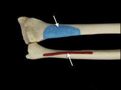 <p>In this view of the right forearm, what muscle attaches to the areas painted in blue and red, as indicated by the arrows?</p>