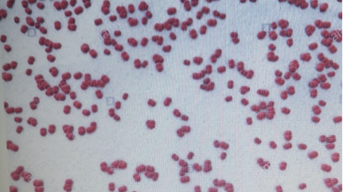 <p><span><span>Ante una imagen como esta (no es una tinción de Gram), la bacteria pertenece a la especie:</span></span></p><p><span><span>a. Staphylococcus epidermidis</span></span></p><p><span><span>b. Staphylococcus aureus</span></span></p><p><span><span>c. Enterococcus faecalis</span></span></p><p><span><span>d. Neisseria meningitidis</span></span></p><p><span><span>e. Streptococcus pyogenes</span></span></p>