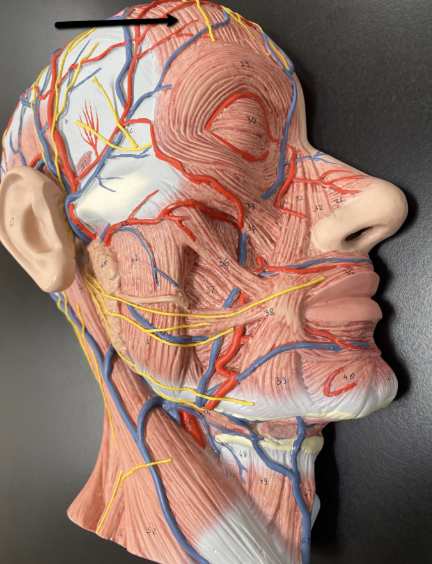 <p>Identify the muscle indicated by the pointer.</p>