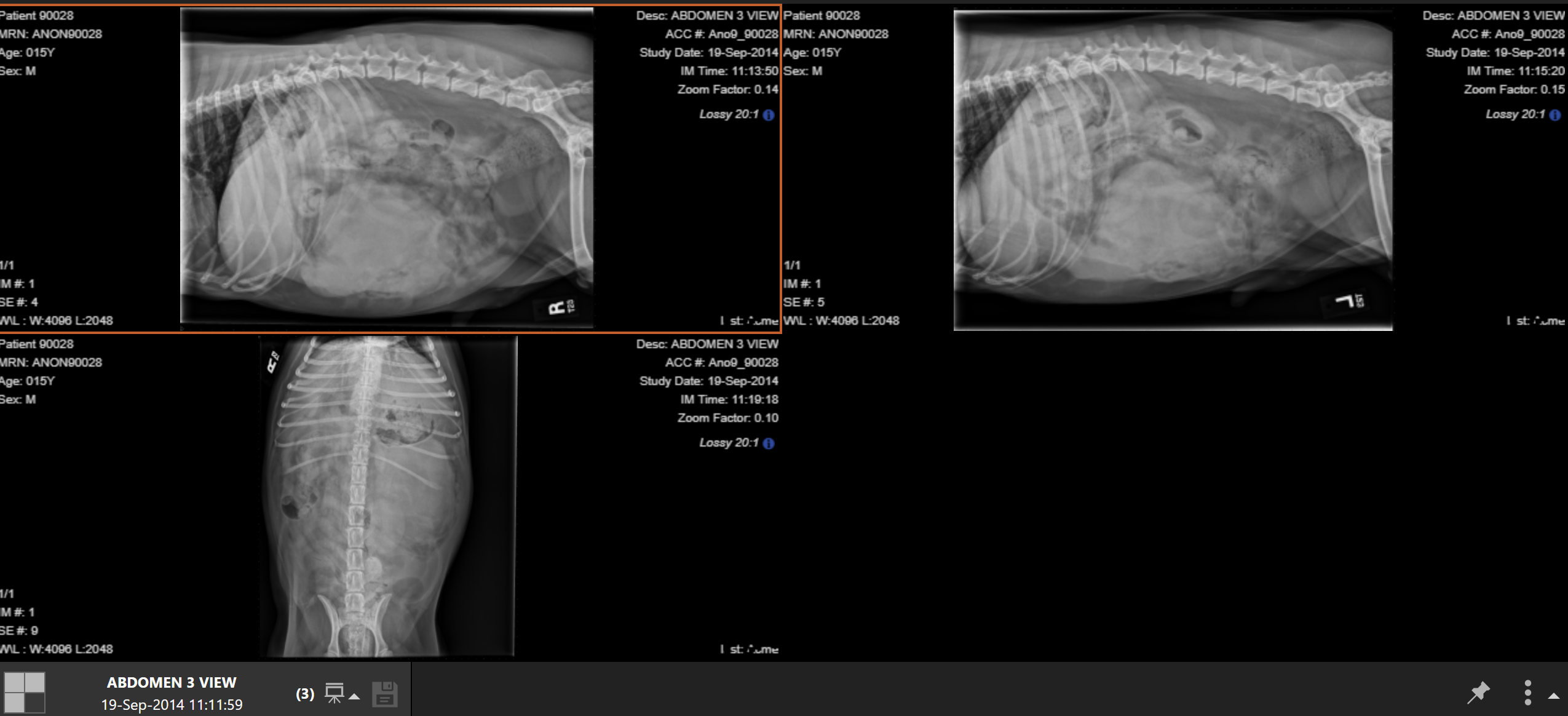 <p>15 YO MN beagle abdominal pain and acute collapse: is the patient overconditioned, normal condition, or underconditioned</p>