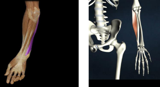 <p>wrist flexion and ulnar deviation</p>