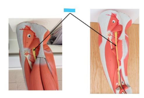 <p>What is the blue arrow?</p>