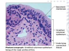 <p>Multiple layers of columnar cells</p><p>Quite rare, seen in segments of male urethra and near anus</p>
