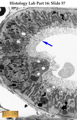 <p><span><span>Where in the nephron loop can we find cells with prominent brush borders as shown?</span></span></p>