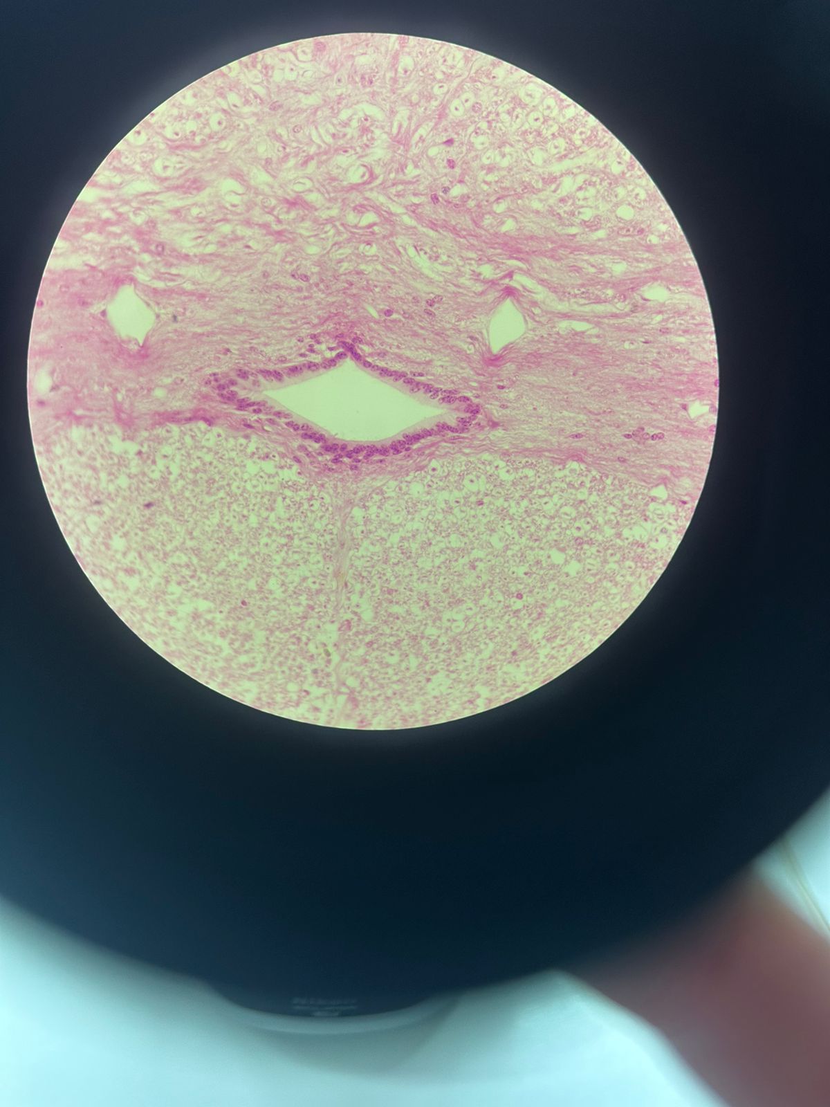 term image