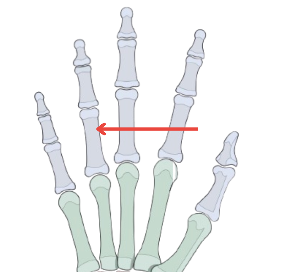 term image