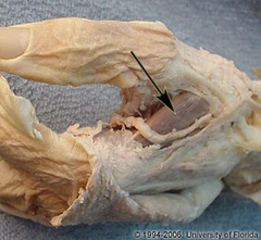 <p>artery</p>