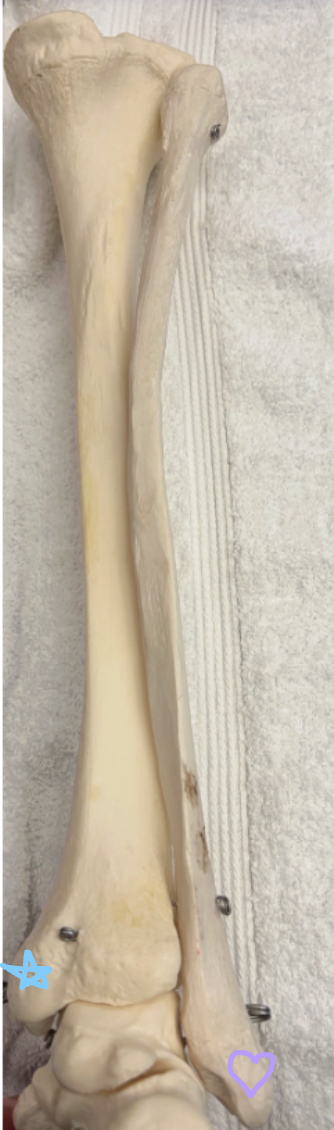 <p>Blue star: What is this structure? What bone articulates with this structure and what ligament attaches here?</p><p>Purple heart: What is this structure? What bone articulates with this structure and what ligaments attaches here?</p>