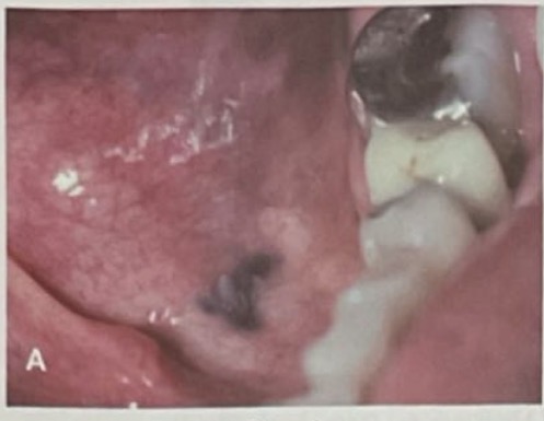 <p>CHẨN ĐOÁN?</p>