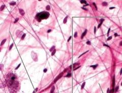 <p>what kind of tissue is being shown in the slide</p>