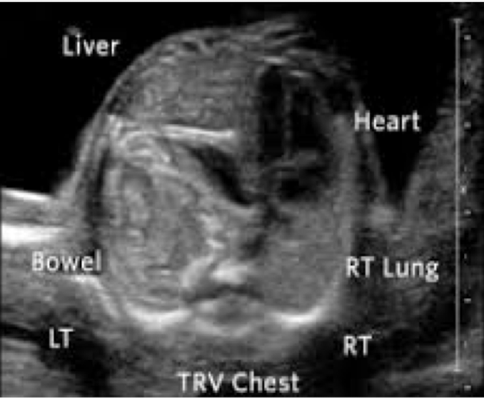 <p>what is this?</p>